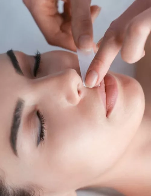 Eine Frau bei der Gesichtsbehandlung. Eine Kosmetikerin trägt ein Wachsstreifen zur Haarentfernung auf der Oberlippe auf.