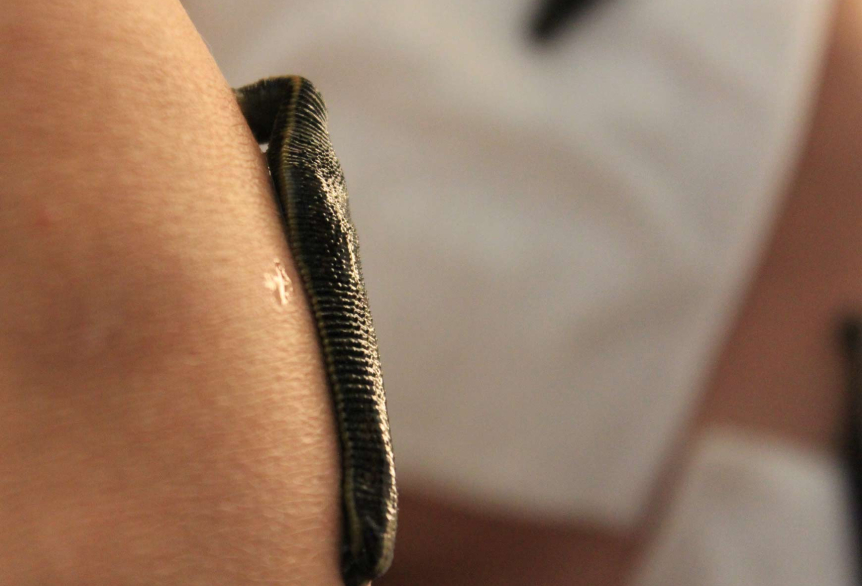 Ein Ausschnitt einer nackten Hautpartie an der ein dunkler Blutegel anliegt und saugt. Im Hintergrund ist ein weiterer Blutegel auf einer Kompresse zu sehen ist. 