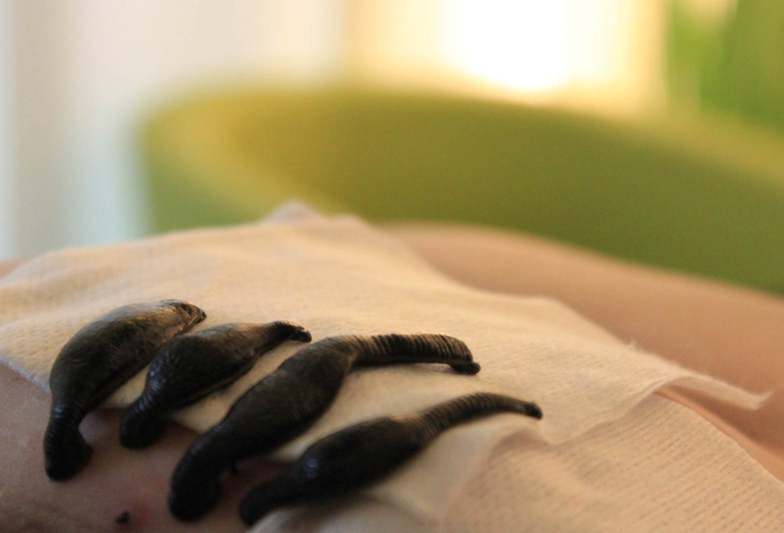 Vier dunkle Blutegel, die auf weiße Kompressen liegen und an der behandelten Körperstelle saugen.Im Hintergrund befindet sich ein verschwommen hell grüner Sessel.